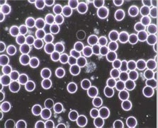 Geldrolleneffekt - Auswirkungen von Mobilfunkstrahlung auf das Blut