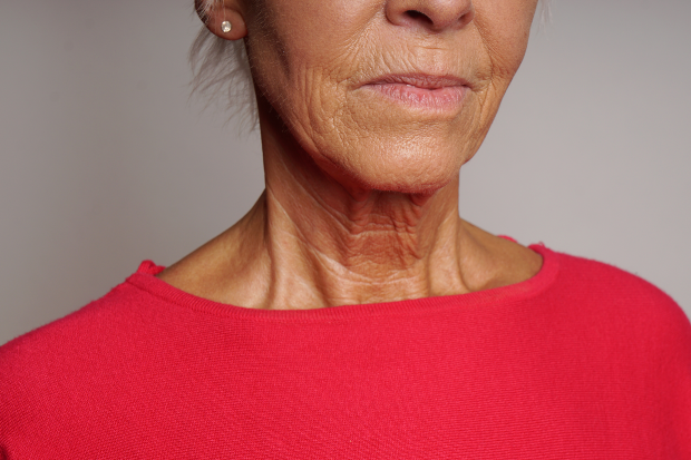 Ältere Dame mit gebräunter Haut, Faltenbildung